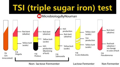 tsi reaction chart.
